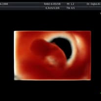 Fetal ultrasound scan